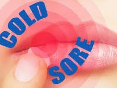 Cold Sores